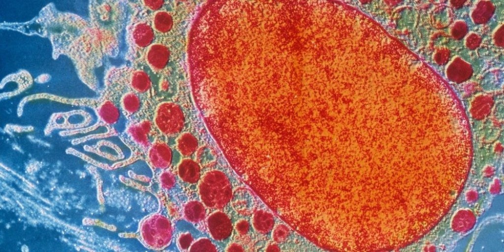 Αντιφλεγμονώδης Διατροφή: Ποια Τρόφιμα μειώνουν τη Φλεγμονή;