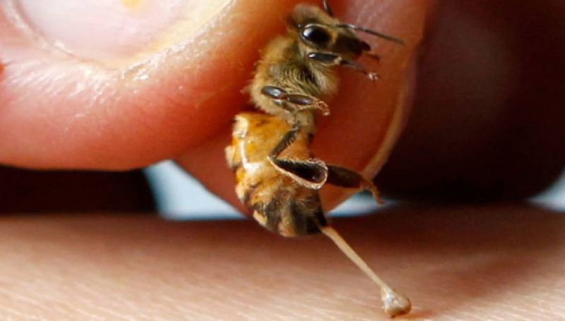 Τί πρέπει να κάνετε όταν σας τσιμπήσει μέλισσα ή σφήκα