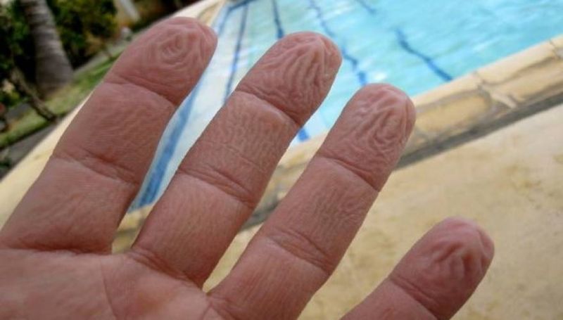 Γιατί ζαρώνουν τα δάχτυλά σας μέσα στο νερό -Όχι, δεν είναι επειδή «μούλιασαν»…