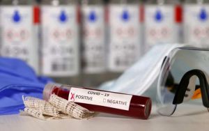 Κορωνοϊός: Αυτό είναι το νέο αντι-ιϊκό φάρμακο για το οποίο μίλησε ο Τσιόδρας